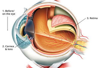 Ophthalmology